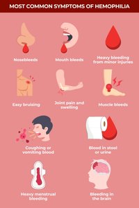 Symptoms of hemophilia