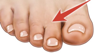 Diagram of Y chromosome