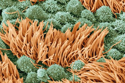 Cilia on cell surface