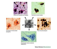 Protein misfolding and disease aggregates