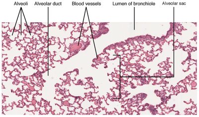 Histological section of alveoli, alveolar ducts, and blood vessels