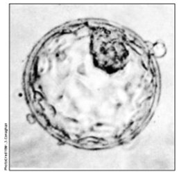 Micrograph of a blastocyst