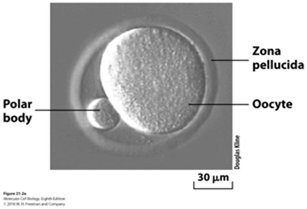 Micrograph of an oocyte with zona pellucida and polar body