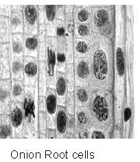 Microtome