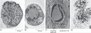 Electron micrographs of normal, apoptotic, and necrotic cells