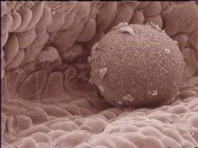 TEM and SEM images