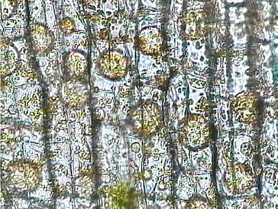 Elodea cells in hypertonic solution