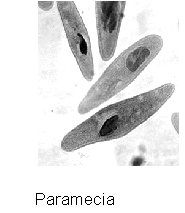 Microtome for slicing tissue samples
