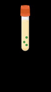Indirect ELISA workflow