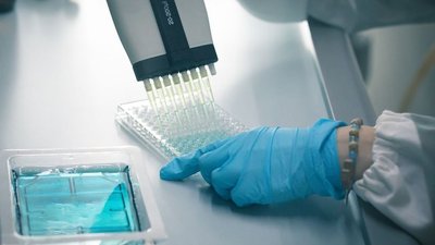 Pipetting ELISA samples
