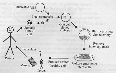 Diagram of somatic cell nuclear transfer and therapeutic cloning