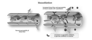 Diagram of vasodilation and normal blood flow