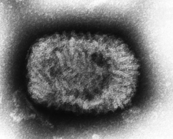 Electron micrograph of smallpox virus particle