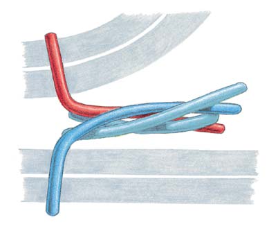 Structure of a trans-SNARE complex