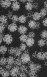 Electron micrograph of clathrin-coated, COPI-coated, and COPII-coated vesicles