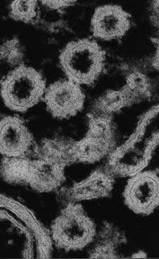 Electron micrograph of COPI-coated vesicles