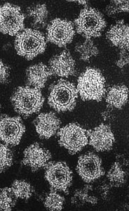 Electron micrograph of COPII-coated vesicles