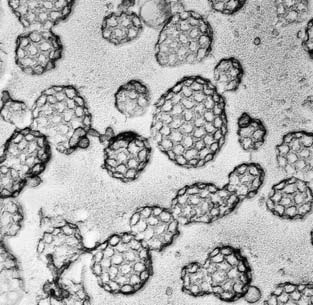 Clathrin-coated pits and vesicles on the inner surface of the plasma membrane