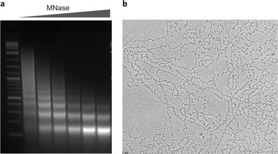 MNase digestion gel and EM image of chromatin showing nucleosome ladder and beads-on-a-string structure