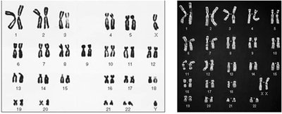 Human karyotype from metaphase-arrested cells