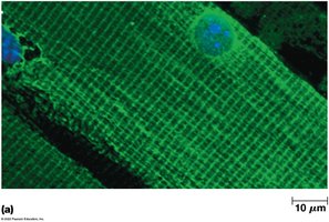 Costamere structure in muscle cells