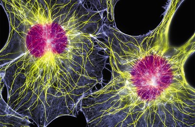 Fluorescent image of cytoskeletal filaments in cells