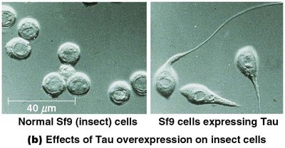 Effects of Tau overexpression on cell morphology