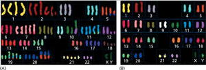 Karyotype comparison showing normal and aneuploid chromosomes
