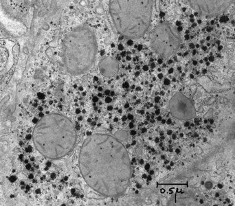 Electron micrograph of glycogen granules in a cell