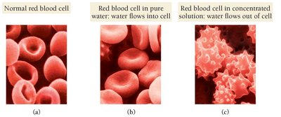 Red blood cells in different osmotic environments