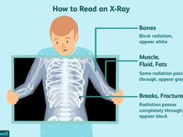 How to read an X-ray