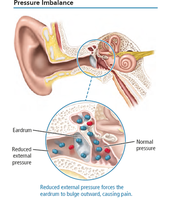 Pressure imbalance in the ear