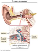 Pressure imbalance in the ear