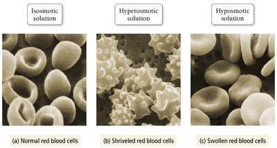 Red blood cells in isosmotic, hyperosmotic, and hyposmotic solutions