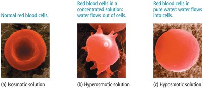 Red blood cells in different osmotic environments