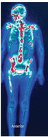 Medical imaging with radioisotopes