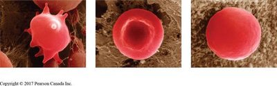 Red blood cells in hypertonic, isotonic, and hypotonic solutions