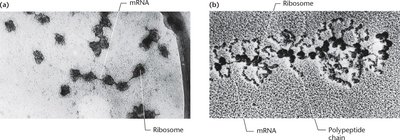 Polyribosomes as seen under the electron microscope