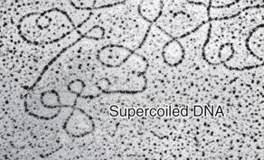 Electron micrograph of supercoiled DNA