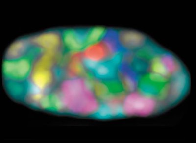 Chromosome territories visualized with colored probes in a human fibroblast nucleus