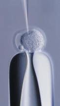 Blastocyst development