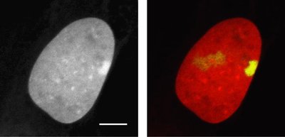 Microscopic image of Barr bodies