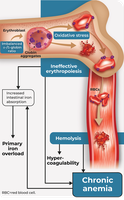 Pathophysiology of beta thalassemia