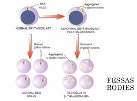 Fessas bodies in beta thalassemia