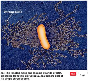E. coli chromosome under electron microscope
