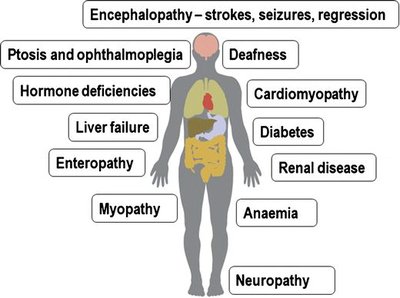 Symptoms of mitochondrial genetic disorders