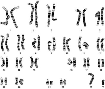 Human karyotype