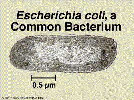 Escherichia coli, a Common Bacterium