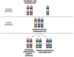 Genetic mechanisms of Prader-Willi syndrome