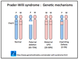 Genetic mechanisms of Angelman syndrome